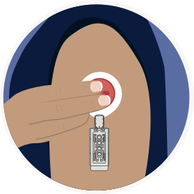 Start the Collection